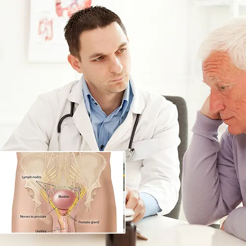 The Penile Implant Process at Urology Surgery Center