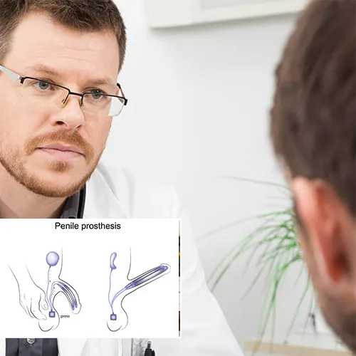 Welcome to  Urology Surgery Center 



: Your Trusted Partner in Penile Implant Management