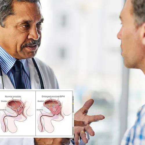 Welcome to  Urology Surgery Center 



: Your Guide to Recovery and Expectations Post-Penile Implant Surgery