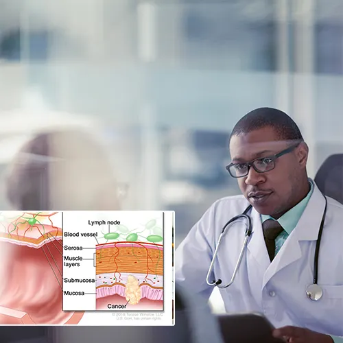 Patient-Centered Recovery at  Urology Surgery Center 


