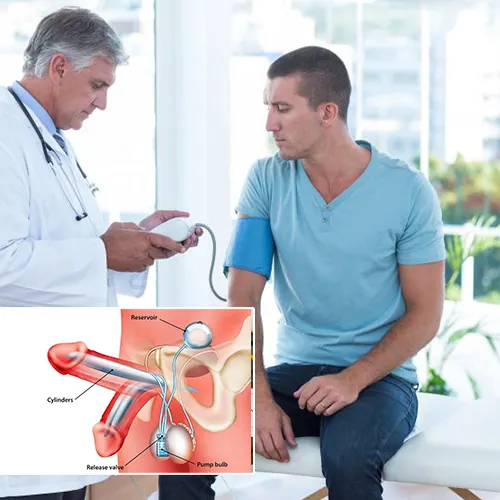 The Impact of Penile Implants on Quality of Life